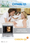 Chison Q5 Ultrasound Imaging System