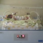 Inkubator bayi lokal