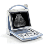 DP-10 Digital Ultrasonic Diagnostic Imaging System