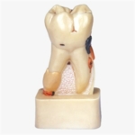 GD/B10008 Dissected Model of Dental Disease