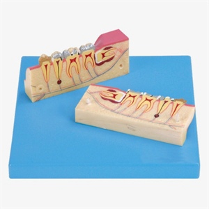 GD/B10007 Dissected Model of Teeth Tissue