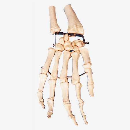 GD/A11126 Palm Bone Model