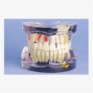 GD/B10056 Mixed Dentition Model(Age 7)