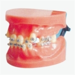 GD/B10038 Fixed Orthodontic Model (Dislocation)