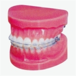 GD/B10036 Fixed Orthodontic Model (Normal)