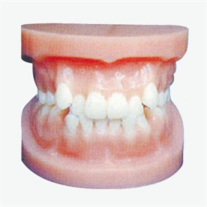 GD/B10035 Orthodontic Model