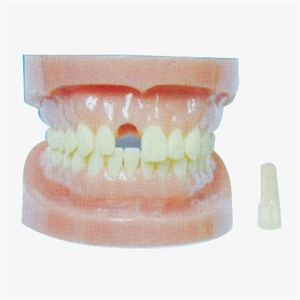 GD/B10028 Detachable Teeth Model without Root