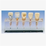 GD/B10015/1 Clinical Model of Endodontics
