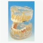 GD/B10012 Transparent Milk Teeth Development Model