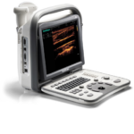 Sonoscape A6 Portable Hand Carried Ultrasound Without Compromise