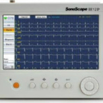 Sonoscape IE6 6 Channel ECG