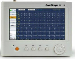 Sonoscape IE6 6 Channel ECG