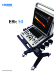 Chison EBit 50 Portable Ultrasound